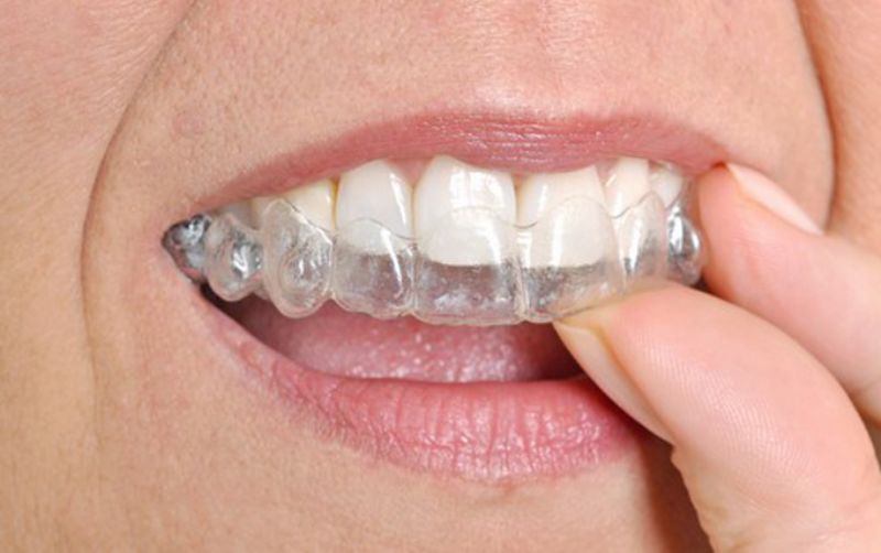 Gece plaklar� mikroplastik sal�yor mu?